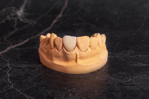 Same-Day Crown on model