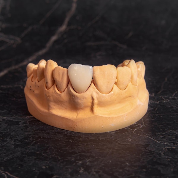 Same-Day Crown on model