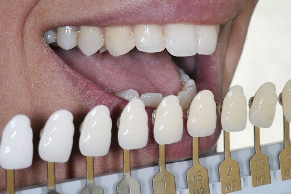 Shade guide next to teeth