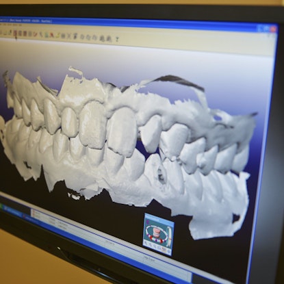 3-D scans of patients jawbone
