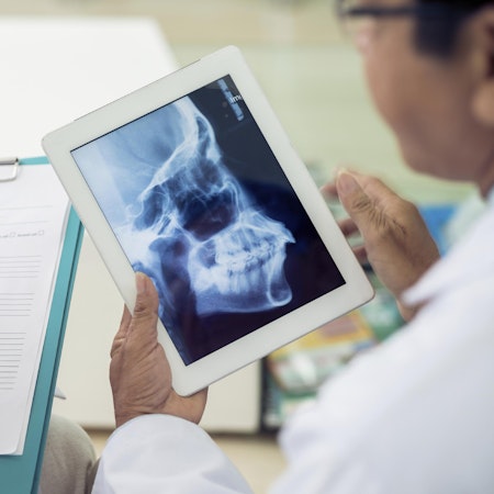 Computer showing x-ray images