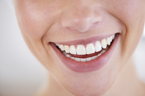 Overlap image of a woman smiling and healthy teeth.