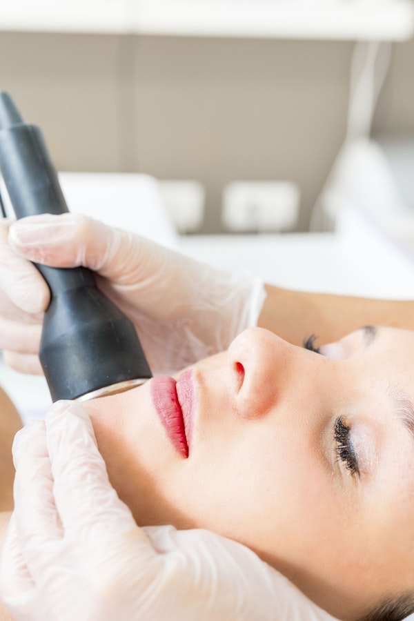 laser skin resurfacing on face