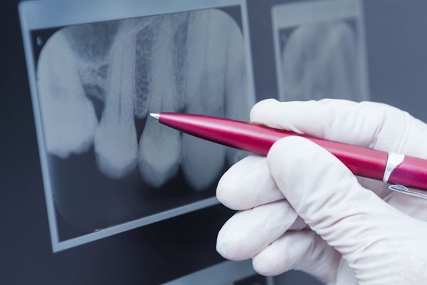 Dentist pointing at x-ray with pen