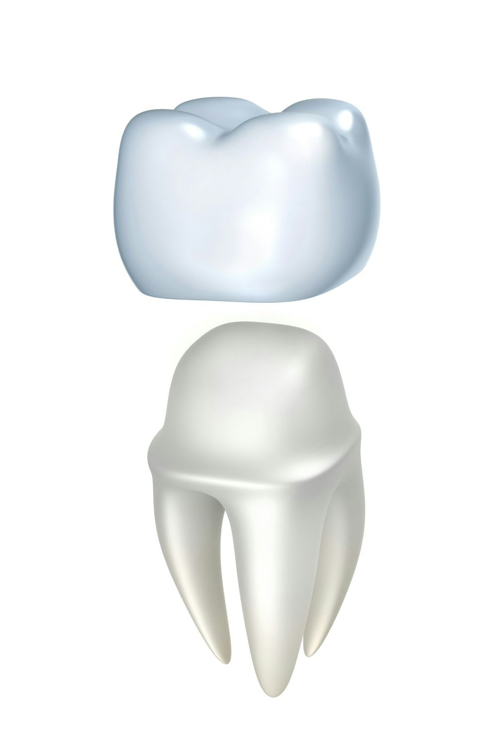 Illustration of a Dental crown