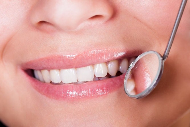 Closeup of white teeth