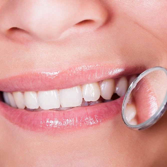 Closeup of white teeth