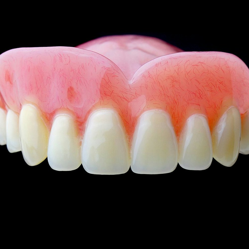 Dentures