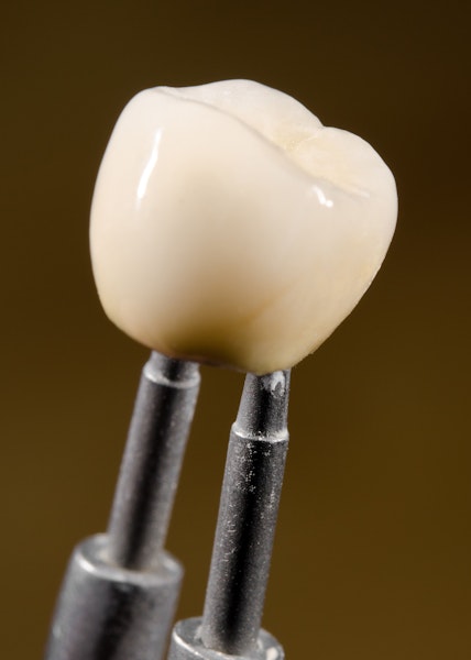 Close up of dental crown