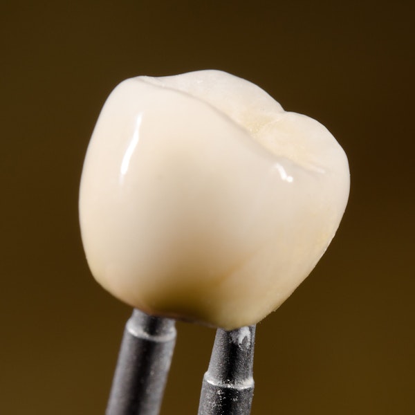 Close up of dental crown