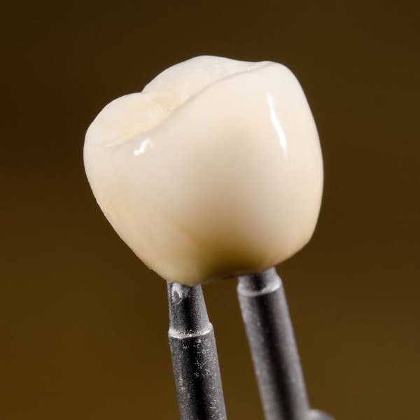Dental Crowns