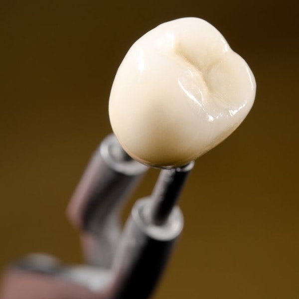 A single dental crown