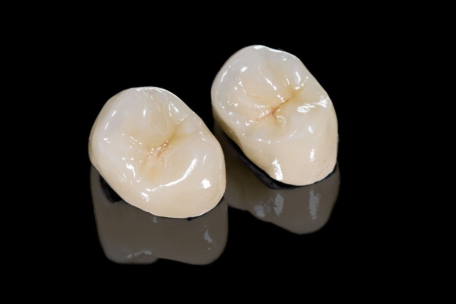 Dental Crowns