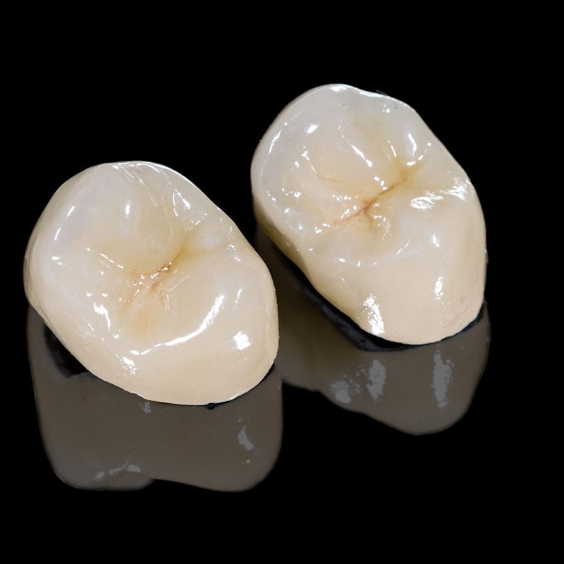 Two porcelain crowns
