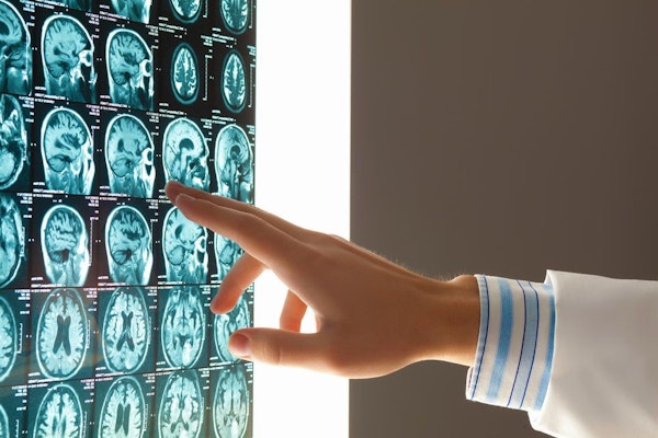 Photo of a hand pointing to a brain scan