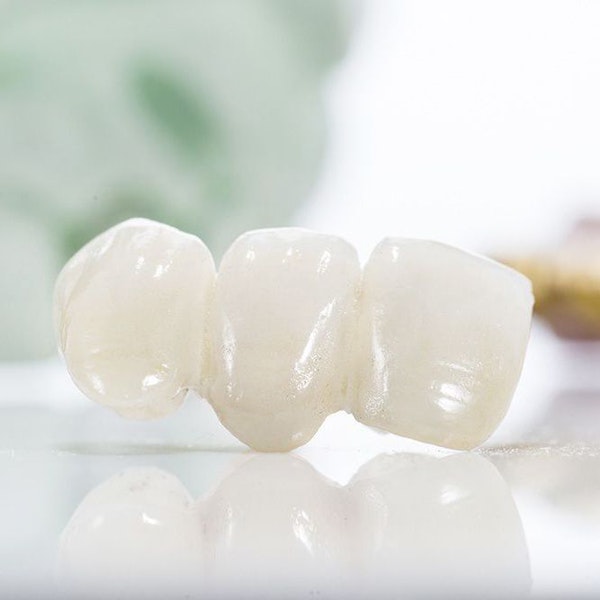 Dental Bridge