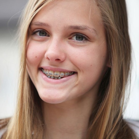 Smiling young girl with braces