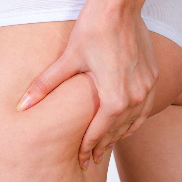Woman pinching top of thigh