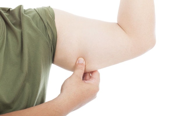 Man pinching skin on upper arm