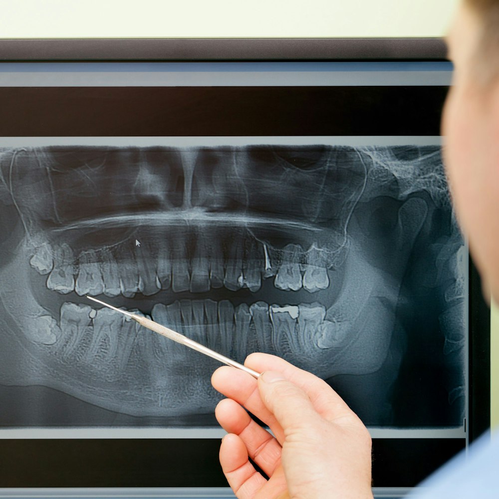 Surgical Instructions