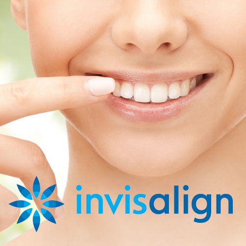 Invisalign promotional image