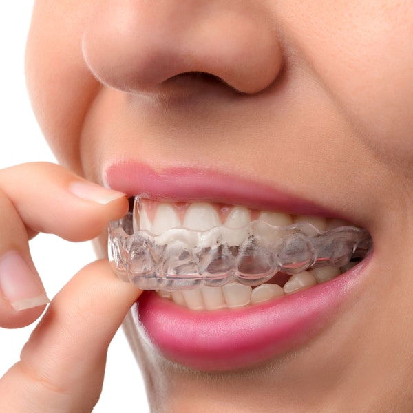 Invisalign aligner over teeth