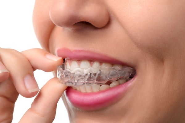 Close up of woman putting on clear orthodontic aligners
