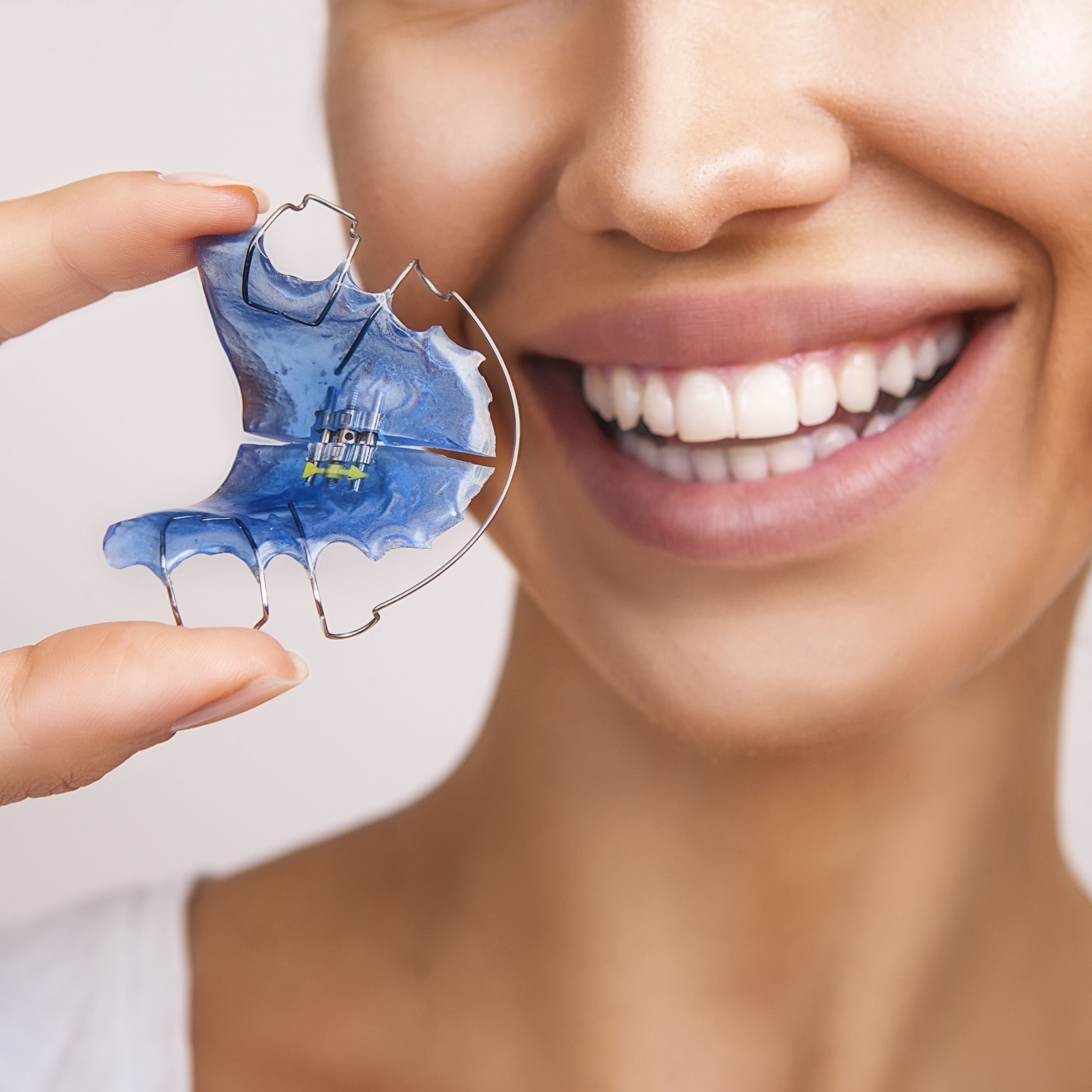 woman with orthodontic mouthpiece