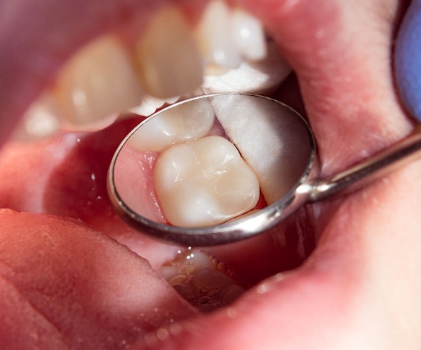 Close up of white filling