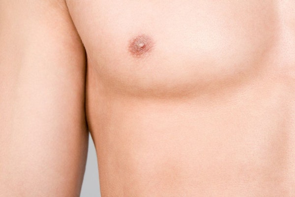 Gynecomastia Correction