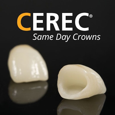 CEREC same day crowns promotional image