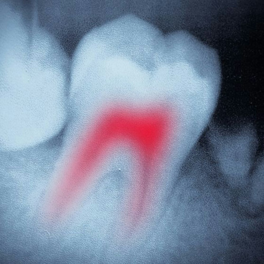 Illustration of a sore tooth