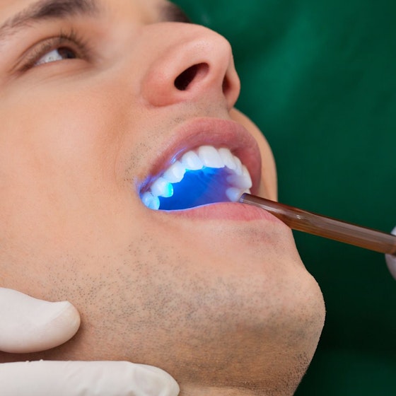 Man undergoing an oral cancer screening with a blue light