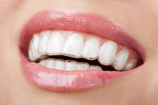 Close up of person wearing Invisalign