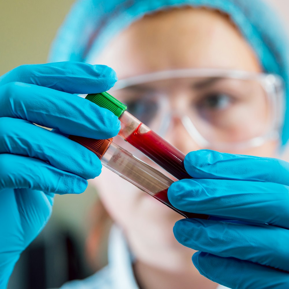 Medical person holding blood samples