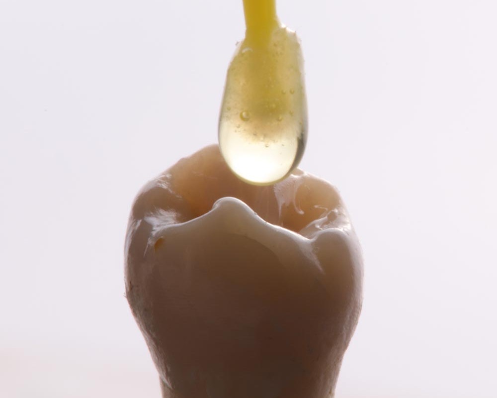 tooth getting resin for dental bonding