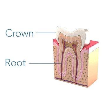 Diagram of natural tooth and root