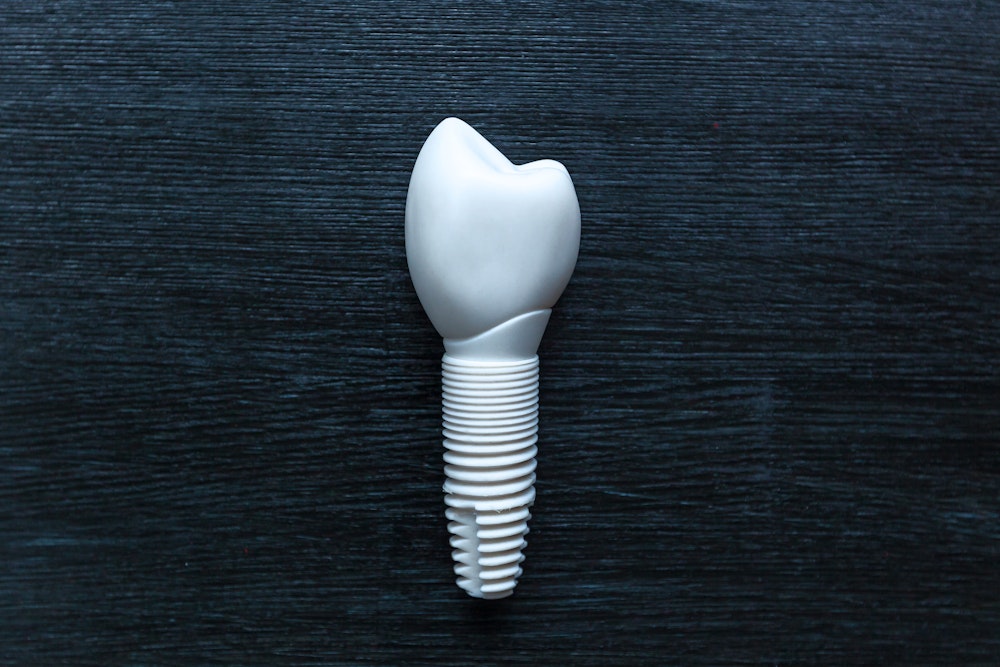Dental implant