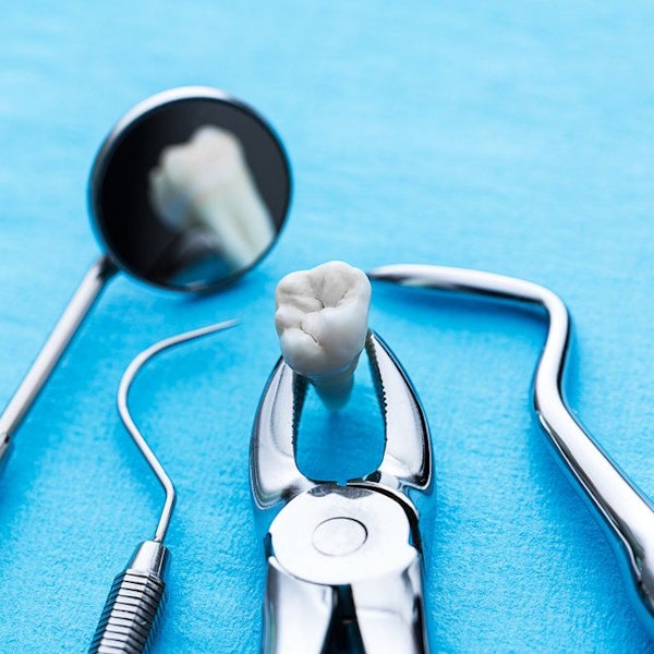 Tooth Extraction