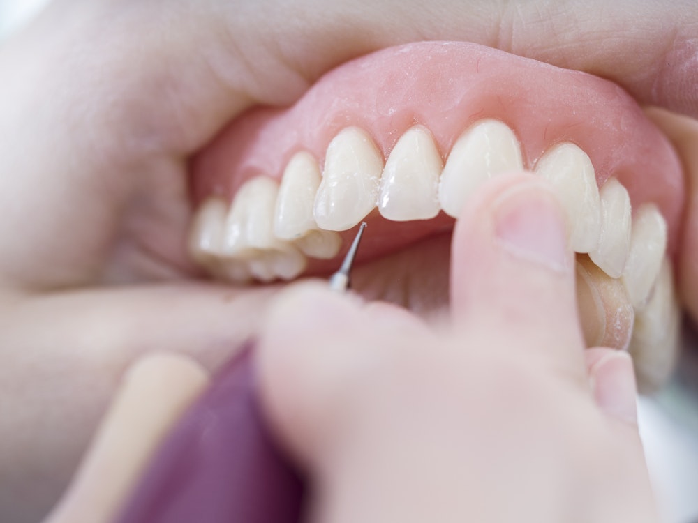 Person cleaning dentures