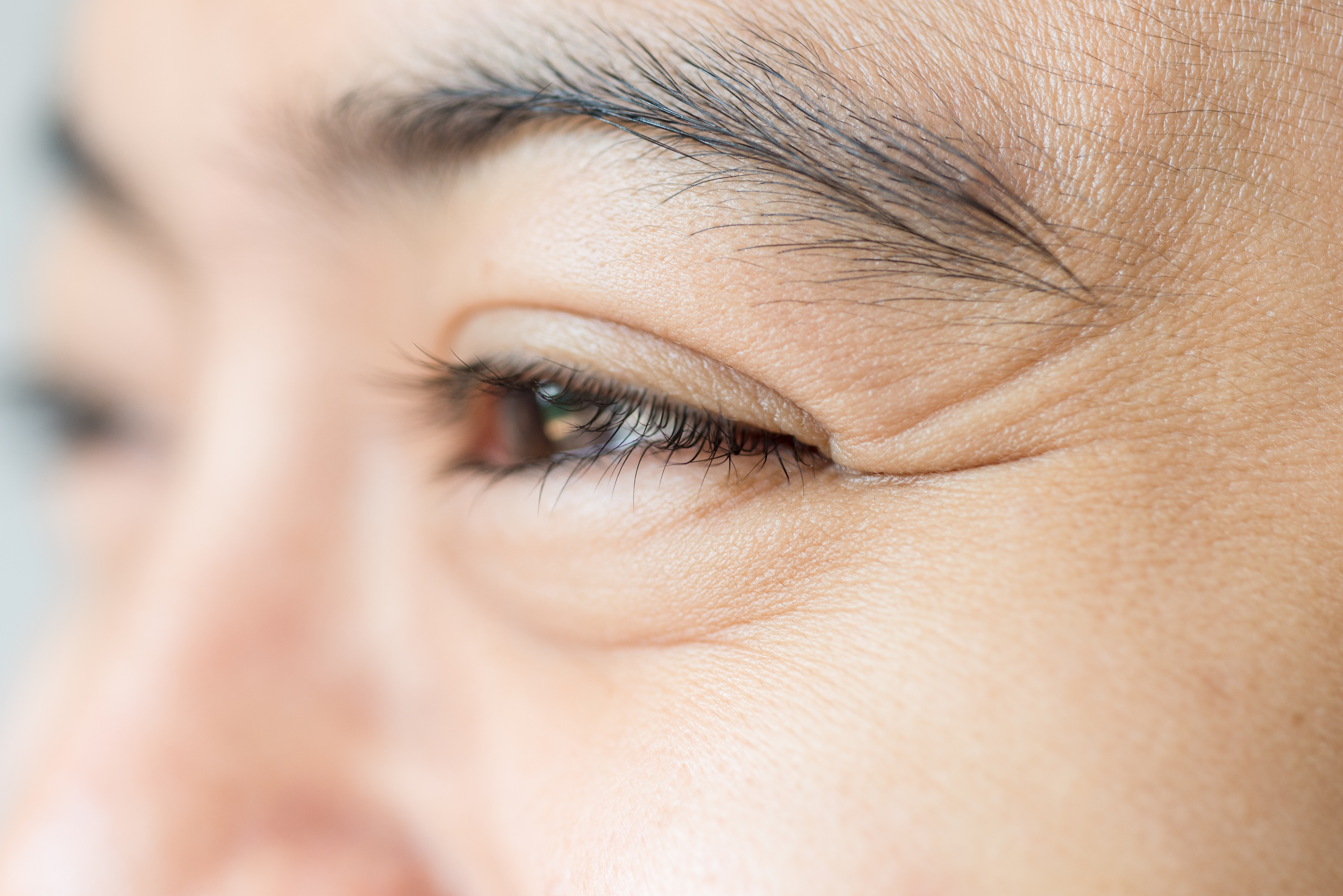 Wrinkles on the Upper Eyelids