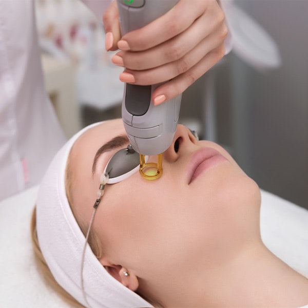 IPL procedure