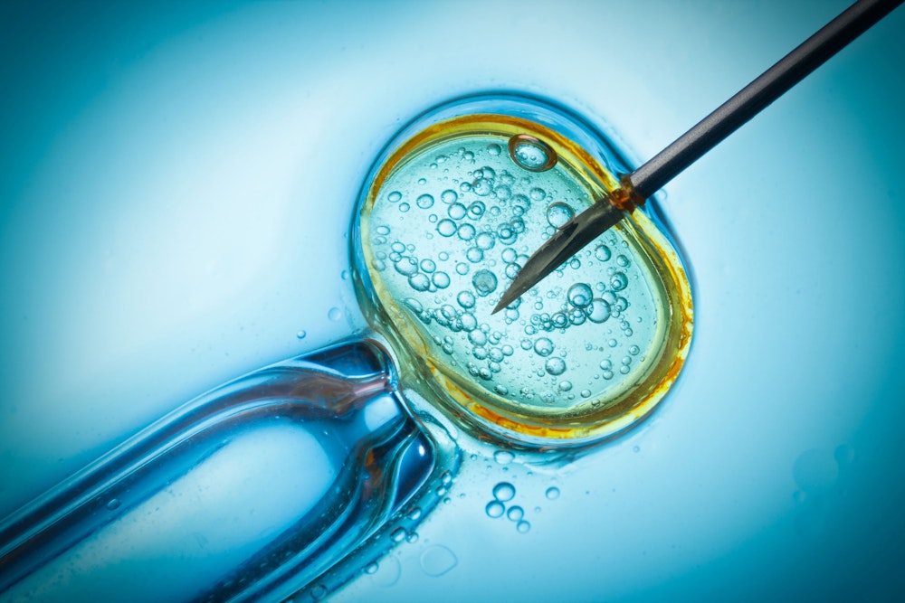 In Vitro Fertilization (IVF)