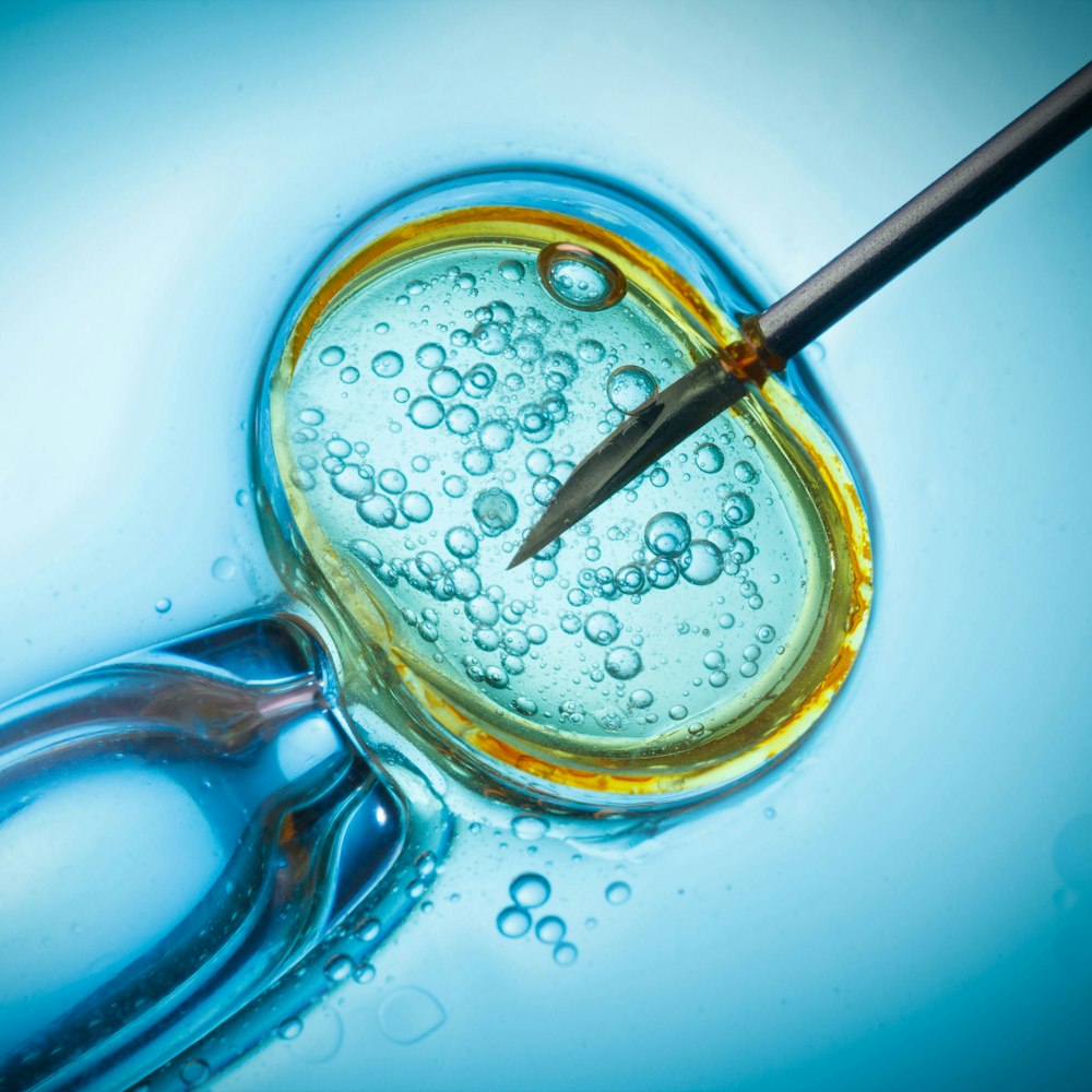 In Vitro Fertilization (IVF)