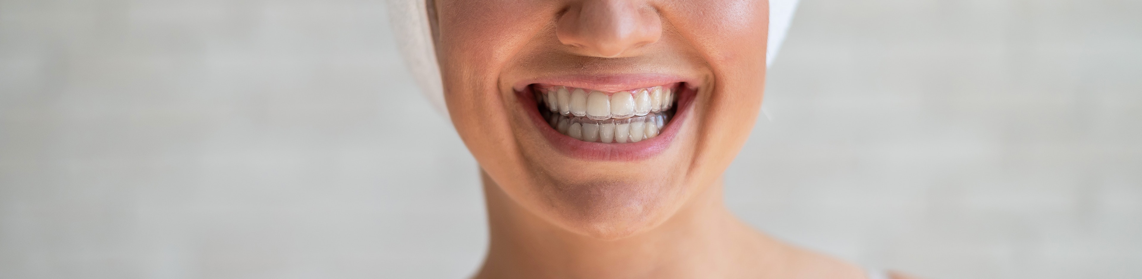 Lady wearing Invisalign