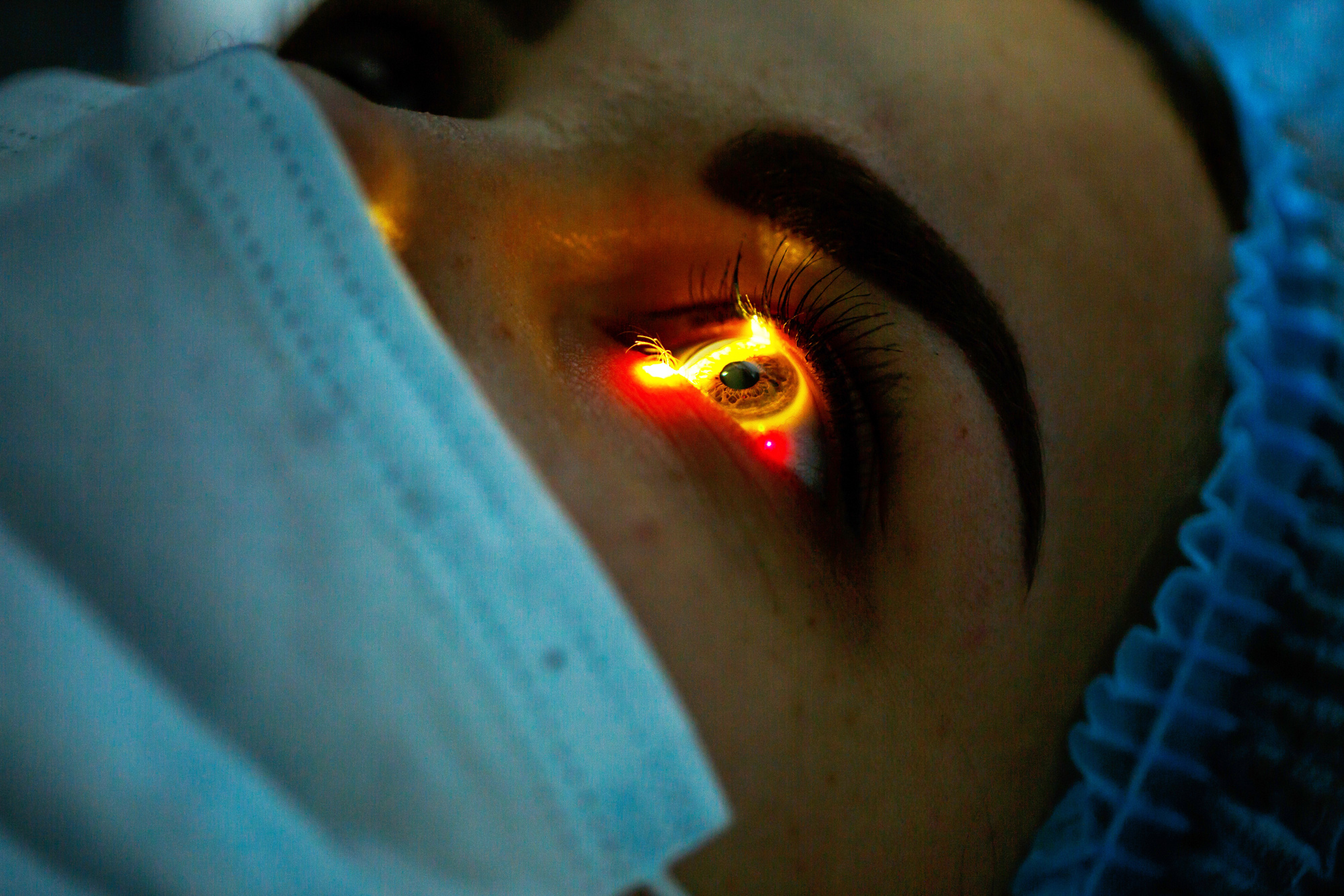 Laser Treatment