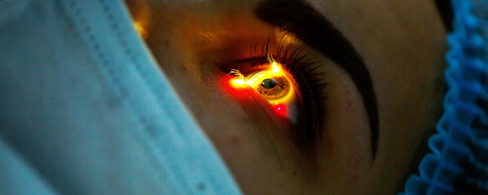 Laser retinal surgery