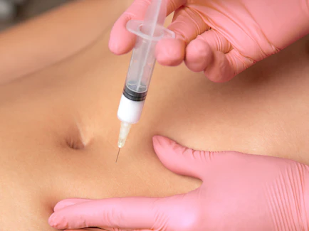 Tumescent Liposuction