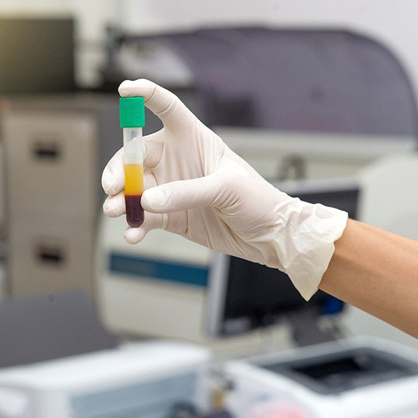 Technician holding vial of separated blood