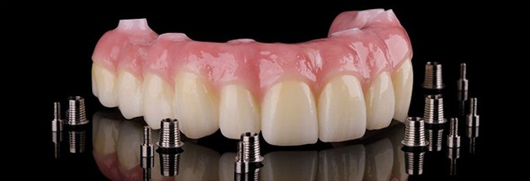 Zirconia bridge